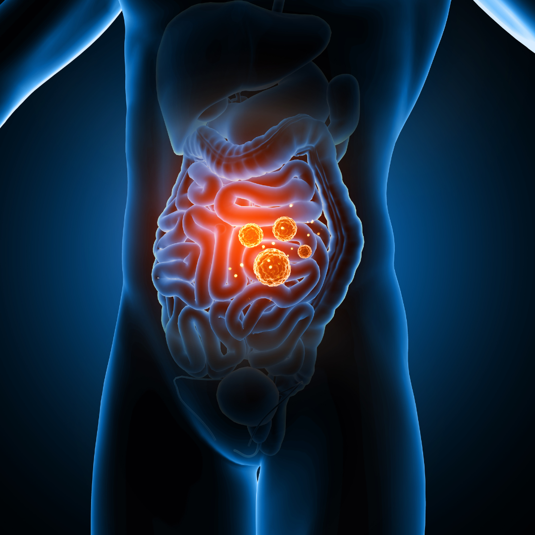 Association Between Sulfur Microbial Diet and the Risk of Esophageal Cancer: A Prospective Cohort Study